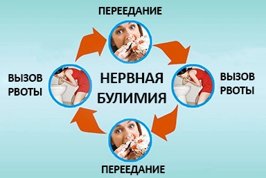 Лечение булимии в Анне